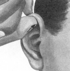 耳鸣-耳痛按摩